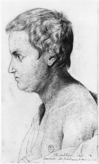 Prostituta idiota affetta da sifilide, illustrazione da un trattato inedito di Jean Etienne Dominique Esquirol (1772-1840) sui pazzi dell